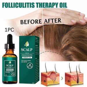 Therapy Oil